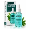 Sérum facial antiacné 30 ml — para granitos y piel grasa